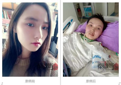 21岁花季女孩被蚊子咬了一口，70多万都没了.....-1.jpg